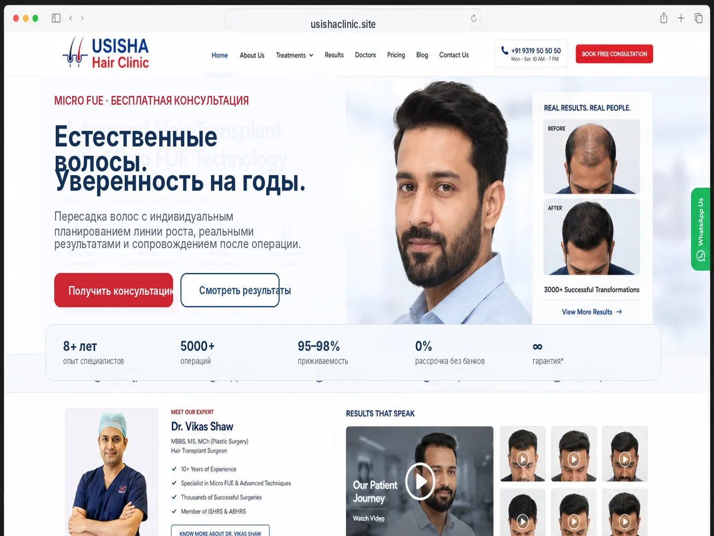 USISHA Hair Clinic — Результаты и видео